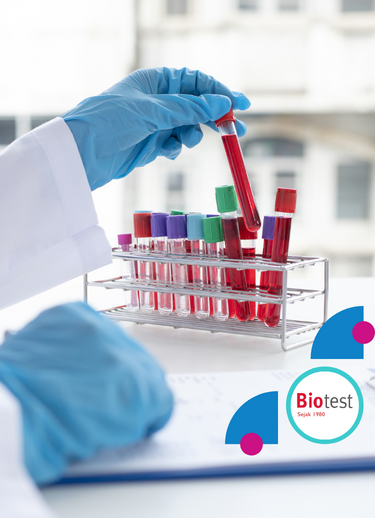 Biotest - Bandung Selatan