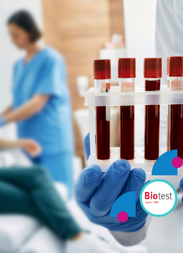 Biotest - Surabaya Barat